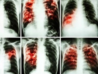 Είναι πιο καρκινογόνα και από το κάπνισμα και όλοι τα χρησιμοποιούμε καθημερινά